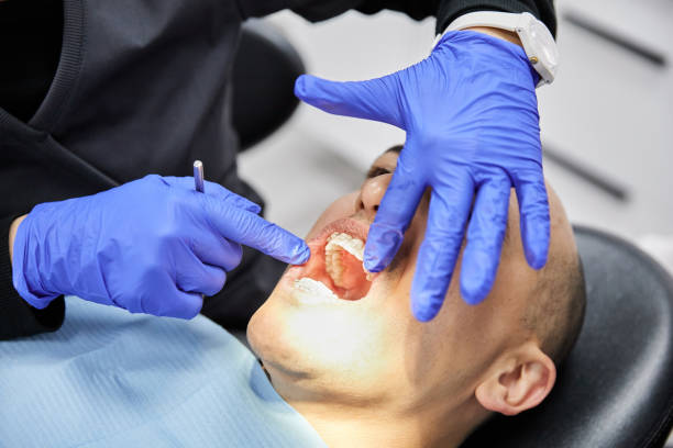 Best Emergency Broken Tooth Repair in Prince Frederick, MD