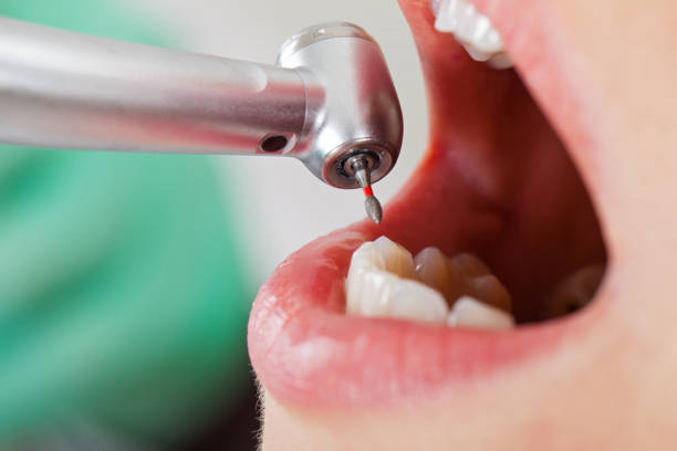 Best Walk-In Emergency Dentist in Prince Frederick, MD